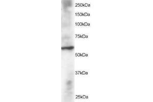 Image no. 1 for anti-Dual Specificity Phosphatase 8 (DUSP8) (N-Term) antibody (ABIN374169) (DUSP8 antibody  (N-Term))