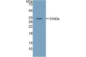 Western blot analysis of recombinant Human PALLD. (PALLD antibody  (AA 1137-1383))