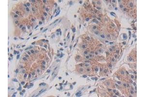 Immunohistochemistry (IHC) image for anti-Legumain (LGMN) (AA 18-433) antibody (ABIN7435007)