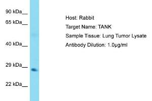 Host: Rabbit Target Name: TANK Sample Tissue: Human Lung Tumor Antibody Dilution: 1ug/ml