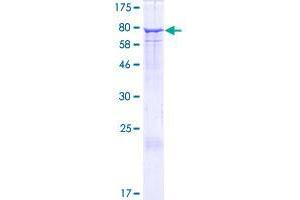 EHD2 Protein (AA 1-543) (GST tag)