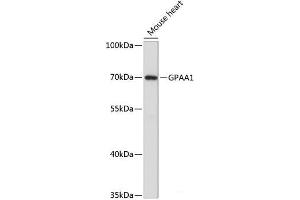 Western blot analysis of extracts of Mouse heart using GPAA1 Polyclonal Antibody at dilution of 1:3000.