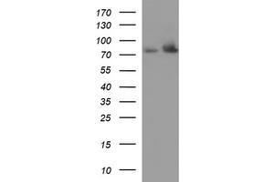 Western Blotting (WB) image for anti-Hydroxysteroid (17-Beta) Dehydrogenase 4 (HSD17B4) antibody (ABIN2715561) (HSD17B4 antibody)