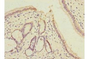 Immunohistochemistry of paraffin-embedded human pancreatic tissue using ABIN7175348 at dilution of 1:100 (VARS antibody  (AA 1-280))