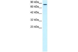 WB Suggested Anti-KIF3B Antibody Titration:  0. (KIF3B antibody  (C-Term))