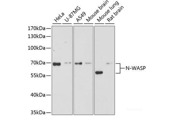 Neural Wiskott-Aldrich syndrome protein (WASL) Antikörper