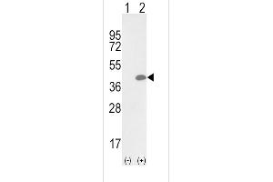 Western Blotting (WB) image for anti-Oxidized Low Density Lipoprotein (Lectin-Like) Receptor 1 (OLR1) (AA 64-92) antibody (ABIN652795)