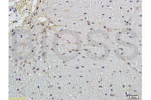 Formalin-fixed and paraffin embedded rat brain labeled with Anti-Claudin 5 Polyclonal Antibody, Unconjugated (ABIN673869) followed by conjugation to the secondary antibody and DAB staining (Claudin 5 antibody)