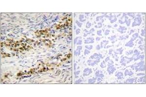 Immunohistochemistry analysis of paraffin-embedded human ovary, using Akt (Phospho-Ser246) Antibody.