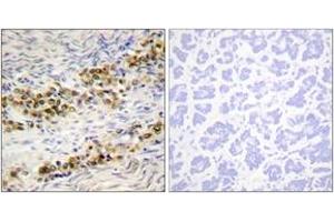 Immunohistochemistry analysis of paraffin-embedded human ovary, using Akt (Phospho-Ser246) Antibody. (AKT1 antibody  (pSer246))