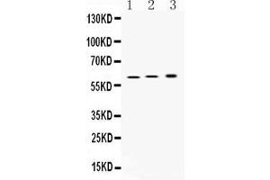 Western blot analysis of ATP4B expression in rat stomach extract ( Lane 1), mouse stomach extract ( Lane 2) and SGC7901 whole cell lysates ( Lane 3). (ATP4b antibody  (N-Term))