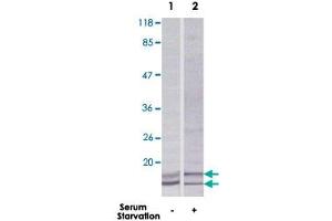 Western blot analysis of extracts from HeLa cells using MAP1LC3A polyclonal antibody . (MAP1LC3A antibody)