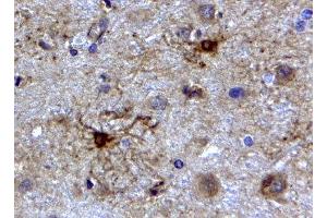 ABIN2562804 (2µg/ml) staining of paraffin embedded Human Cerebellum. (GFAP antibody  (C-Term))