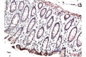 Immunohistochemical analysis of paraffin-embedded Human Colon Carcinoma Tissue using HP-1γ Mouse mAb diluted at 1:200 (CBX3 antibody)