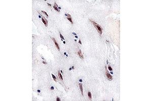 Immunohistochemical analysis of paraffin-embedded H. (CSNK2A1/CK II alpha antibody  (AA 250-284))