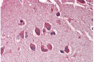 Human Brain, Cortex: Formalin-Fixed, Paraffin-Embedded (FFPE) (Adlican antibody  (AA 1454-1467))