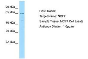 Image no. 1 for anti-Neutrophil Cytosolic Factor 2 (NCF2) (AA 429-478) antibody (ABIN6749984) (NCF2 antibody  (AA 429-478))