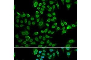 Immunofluorescence (IF) image for anti-Lamin B2 (LMNB2) antibody (ABIN7262334)