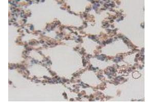 Figure. (ITGAD antibody  (AA 879-1099))