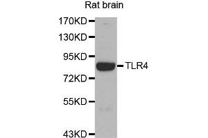 Western blot analysis of Rat brain tissue lysate using TLR4 antibody. (TLR4 antibody)