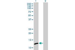 Western Blot analysis of C1orf38 expression in transfected 293T cell line by C1orf38 MaxPab polyclonal antibody. (C1orf38 antibody  (AA 1-132))