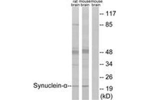 Western blot analysis of extracts from rat brain/mouse brain cells, using Synuclein-alpha (Ab-125) Antibody.