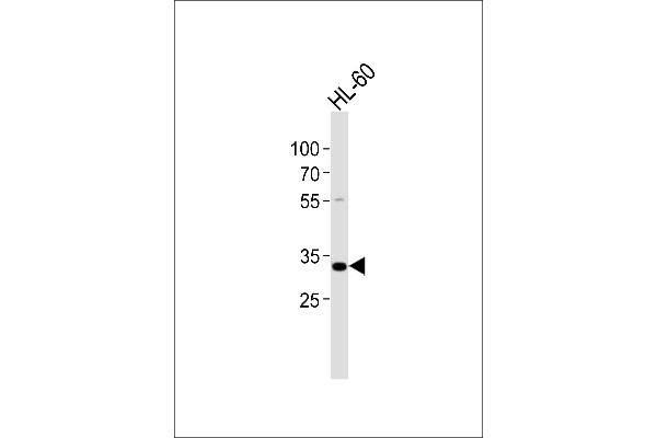 TREX2 antibody  (C-Term)