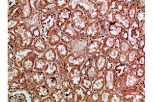 Immunohistochemistry (IHC) image for anti-REL proto-oncogene (c-Rel) (AA 491-540) antibody (ABIN7189505)