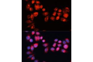 Immunofluorescence analysis of HeLa cells using  antibody (ABIN7265735) at dilution of 1:100 (40x lens).