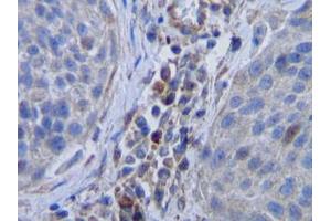 Image no. 1 for anti-Colony Stimulating Factor 1 (Macrophage) (CSF1) antibody (ABIN465551) (M-CSF/CSF1 antibody)