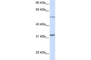 WB Suggested Anti-SLC35A5 Antibody Titration:  0. (SLC35A5 antibody  (N-Term))