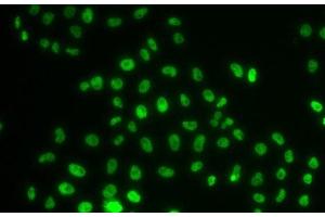 Immunofluorescence analysis of MCF-7 cells using PHIP Polyclonal Antibody (PHIP antibody)