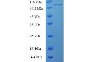 SDS-PAGE (SDS) image for Polynucleotide Kinase 3'-Phosphatase (PNKP) (AA 1-521), (full length) protein (His-SUMO Tag) (ABIN5711719)
