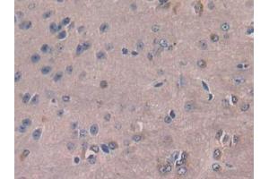 IHC-P analysis of Mouse Cerebrum Tissue, with DAB staining. (M-CSF/CSF1 antibody  (AA 33-204))