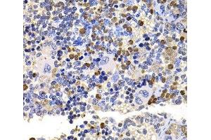 Immunohistochemistry of paraffin-embedded Rat spleen using UBE2V2 Polyclonal Antibody at dilution of 1:100 (40x lens). (UBE2V2 antibody)