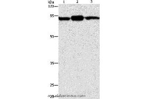 Western blot analysis of Mouse brain and skin tissue, 293T cell , using CAPN2 Polyclonal Antibody at dilution of 1:200 (Calpain 2 antibody)