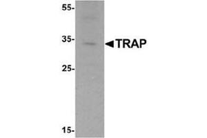 Western blot analysis of TRAP in mouse brain tissue lysate with TRAP Antibody  at 1 ug/mL.