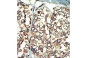Image no. 2 for anti-Phosphatidylinositol 4-Kinase Type 2 beta (PI4K2B) (C-Term) antibody (ABIN360474) (PI4K2B antibody  (C-Term))