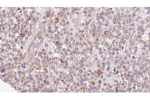 SH3KBP1 antibody  (N-Term)