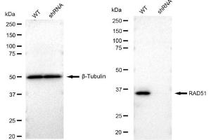 Western blotting analysis using RAD51 antibody (ABIN7798366). (Recombinant RAD51 antibody)