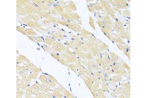 Immunohistochemistry of paraffin-embedded Mouse heart using EIF2S1 Polyclonal Antibody at dilution of 1:100 (40x lens). (EIF2S1 antibody)
