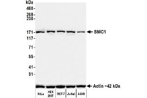 Western Blotting (WB) image for anti-Structural Maintenance of Chromosomes 1A (SMC1A) (C-Term) antibody (ABIN7455193) (Recombinant SMC1A antibody  (C-Term))