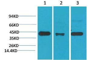 Western Blot (WB) analysis of 1) HeLa, 2)Mouse Brain Tissue, 3) Rat Brain Tissue with TBP/TATA Binding Protein Mouse Monoclonal Antibody diluted at 1:2000.