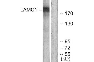 Western Blotting (WB) image for anti-Laminin, gamma 1 (LAMC1) (C-Term) antibody (ABIN1850458) (Laminin gamma 1 antibody  (C-Term))