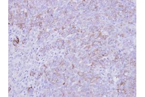 IHC-P Image Immunohistochemical analysis of paraffin-embedded DLD-1 xenograft , using SLC26A8, antibody at 1:500 dilution. (SLC26A8 antibody  (C-Term))