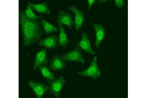 Immunofluorescence analysis of A549 cells using CDC5L antibody. (CDC5L antibody)