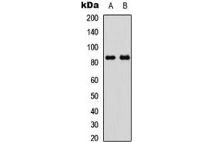 Western blot analysis of GYS1 (pS645) expression in HeLa insulin-treated (A), NIH3T3 insulin-treated (B) whole cell lysates.