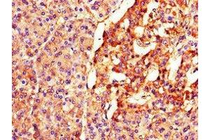 Immunohistochemistry of paraffin-embedded human pancreatic tissue using ABIN7152495 at dilution of 1:100 (BTRC antibody  (AA 397-448))