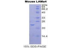 SDS-PAGE (SDS) image for Laminin, alpha 4 (LAMa4) (AA 457-630) protein (His tag) (ABIN1877795) (LAMa4 Protein (AA 457-630) (His tag))