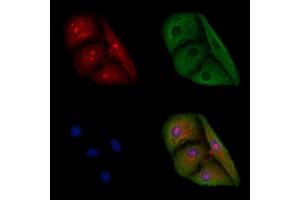 ABIN6258202 and ABIN6276045 staining  cells by IF/ICC.